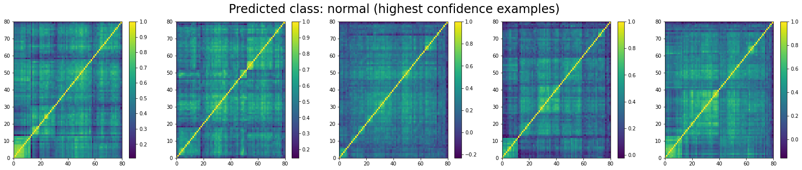 The top 5 'normal' correlation matrices in the test set according to the model